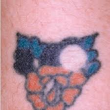 People who decide to get a tattoo rarely think carefully before hiring an artist that will create a permanent drawing on their skin. A The First Freedom 2 Tattoo Is Being Placed In The Arm Of The Ceo Of Download Scientific Diagram