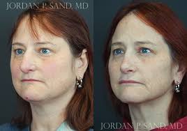 Jordan P. Sand, M.D., F.A.C.S.