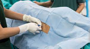 Recovery Tips For Side Effects Of Epidural Injections
