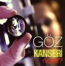 Goz Kanseri Nedir