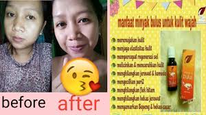 Manfaat minyak bulus, berkualitas, dan mudah bukan cara pakai minyak bulus? Skincare Sr12 Review Minyak Bulus Asli Sr12 Testimoni Carapakai Wulansarinah By Wulan Sarinah