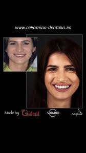 Gident dental lab and training center