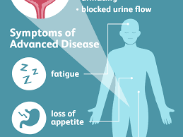 Sometimes, people with bladder cancer do not have any of these changes. Signs And Symptoms Of Bladder Cancer