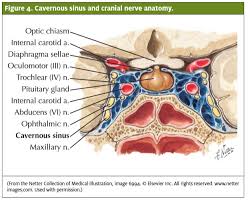 Nasal vestibulitis refers to diffuse and shallow inflammation of nasal vestibular skin, mostly with bilateral onset. Painful Nose Crusting In A Child Journal Of Urgent Care Medicine