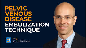 What is your embolization technique for the ovarian vein? #embolization