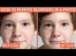 Unlike other apps, blemish remover does not simply 'blur' the target area. How To Remove Skin Blemishes Spots And Other Imperfections From Photos Youtube