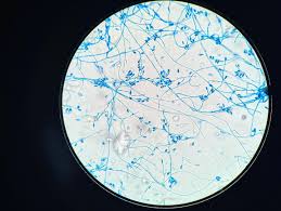 Image result for Microchloa altera