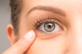 sunken eyes: 4 things you should know