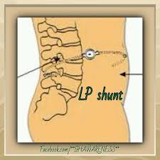 Pin On Longlostmixtape Life