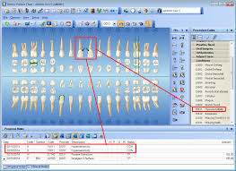 Dentrix Patient Chart Toolbar Missing New Pt In Dentrix