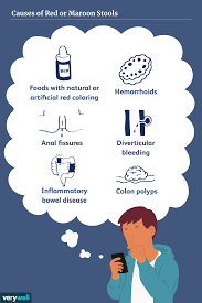 Image result for blood in stool human poop