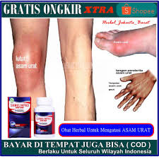 Cara mengobati asam urat tidak cukup hanya dengan obat dari dokter. Obat Untuk Sendi Bengkak Akibat Asam Urat Sendi Nyeri Akibat Asam Urat Samulinpro Sehat Sendi Shopee Indonesia