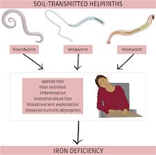 Image result for Helminth