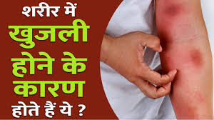 Pin On Symptoms Of Kidney Infection