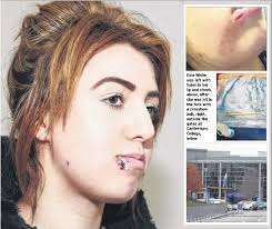 Evie's terror after being shot with crossbow bolt