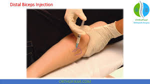 Image result for Elbow Joint Injection