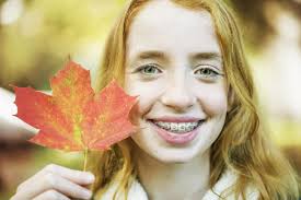 National Orthodontic Month: Conveying The Importance of Braces in Cypress,  TX