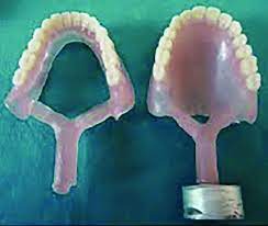 Flexible Acrylic Denture Download Scientific Diagram