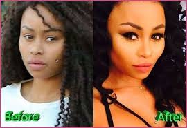 Blac Chyna Before She Was Famous Plastische Chirurgie Von Blac Chyna Vor Und Nach Fotos Die Ganze Geschichte Die Kosmetische Chir Hair Implants Plastic Surgery Blac Chyna Plastic Surgery