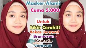 Maybe you would like to learn more about one of these? Masker Alami Buat Jerawat Komedo Mencerahkan Wajah Bekas Jerawat Hilang Youtube