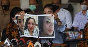 Suami nindy ayunda, askara parasady harsono, mengamuk hingga melakukan kekerasan terhadap nindy saat nindy ayunda dan askara parasady harsono saat masih bersama. Lihat Nindy Ayunda Alami Kdrt Anak Anak Ngadu Ke Neneknya