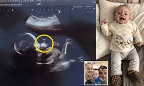 Baby 'flips the bird' in ULTRASOUND | Daily Mail Online