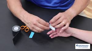 Mallet finger is a condition often seen after sports related trauma that causes the finger tip to droop, sometimes confused as a. Mallet Finger Physiopedia