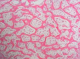 The light spot is a canal that carries a blood vessel and a nerve fiber. Spongy Bone