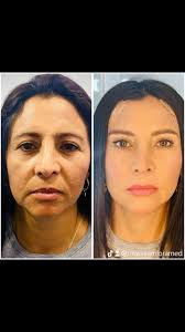 Dr William Lora (@williamloramed) • Threads, Say more