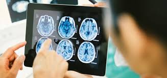 Image result for BENEFICIO DO SALMAO PARA A SAUDE