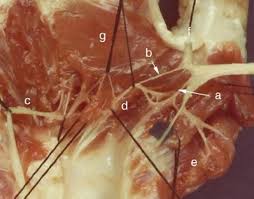 Most common nerve anastomosis pattern. Riche Cannieu Anastomosis Structure Function And Clinical Significance