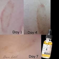 Pomifera Before/After | Simply Beautiful Hair & Skin | United States
