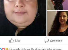 Fundraiser by Lisa Rodriguez-galbally : Lisa Rodriguez .Bariatric skin  extra skin removal