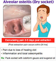 Check spelling or type a new query. Pin By Kelsey Szwayka On Teeth Rdh In 2021 Dental Hygiene School Dental Life Dentistry