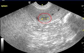 Tumors on the spleen can be benign or cancerous. Spleen Cancer In Dogs Cats Long Beach Animal Hospital