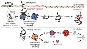 In the previous trade, the precious metal had closed at rs. Jci Respiratory Syncytial Virus Infection Exacerbates Pneumococcal Pneumonia Via Gas6 Axl Mediated Macrophage Polarization
