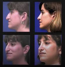 Berman Plastic Surgery & Spa, 670 Glades Rd, Ste 240, Boca Raton, FL 33431,  US