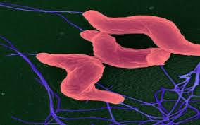 Farbe, geruch, beschaffenheit des stuhls geben auskunft über unsere gesundheit. Campylobacter Infektion Ursachen Symptome Therapie Onmeda De