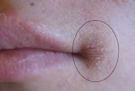 We did not find results for: Angular Cheilitis Symptoms Treatment And Causes