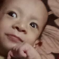 😭 Sobrang GRABEEE TO❗Dislocated Patella...🥺