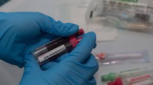 Da, ziarul romania libera este un cotidian tiparit national, ce se distribuie si apare in toata tara. Un Roman Sanatos De 46 De Ani A Murit De Coronavirus Medicul Care L A Ingrijit Povesteste Ce S A Intamplat Mobile