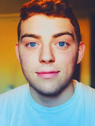 One Of The Rarest Genetic Combinations In Human History Red Hair Blue Eyes Oc 3024x4032 Red Hair Blue Eyes Blue Hair Human