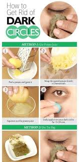 Diy How To Get Rid Of Dark Circles Under Eyes Dark Circle Remedies Skin Care Remedies Skin Remedies