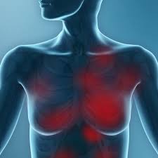 If it seems like something someone might print if someone has to visually bop around your guide to find what they are looking for, the guide does not 4. Algorithm Detects Biomarker In Aggressive Breast Cancer Healthcare In Europe Com