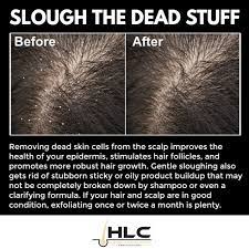 Slough The Dead Stuff Removing Dead Skin Cells From The Scalp Improves The Health Of Your Epidermis Stimulates Hair Follicle Remove Dead Skin Cells Epidermis