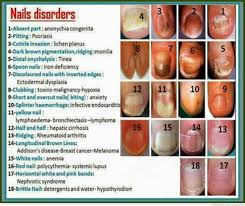 The Nails Have It Medical Facts Nail Disorders Health