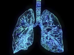 Image result for Chronic Bronchitis