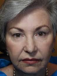 The Better Blepharoplasty