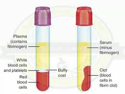 Difference Between Plasma And Serum Phlebotomy Study Medical Lab Technician Medical Laboratory Science