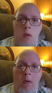 Kevin Shows His Face